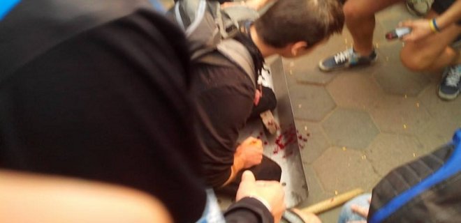 Столкновения в Одессе: за медпомощью обратились 174 человека - Фото