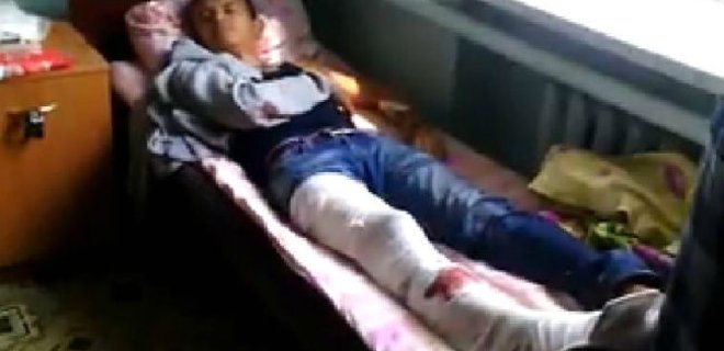 Выжившие переселенцы сообщили подробности атаки боевиков: видео - Фото
