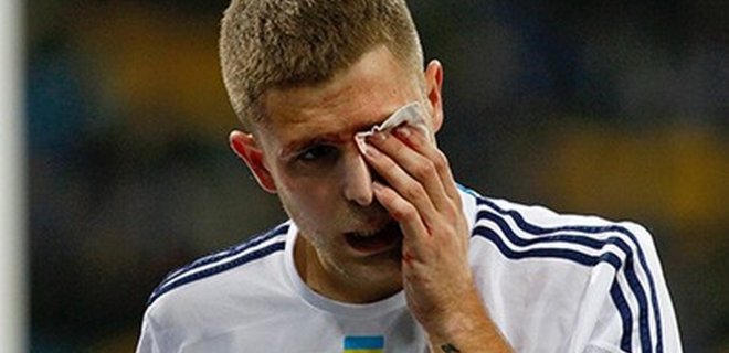 Украина теряет двух игроков перед играми с Люксембургом и Литвой - Фото