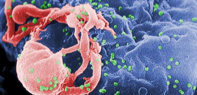 Успешно испытан на людях препарат на основе антител к ВИЧ - Фото