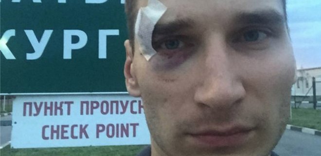 Боевики избили журналиста из РФ, снимавшего протест в Донецке - Фото