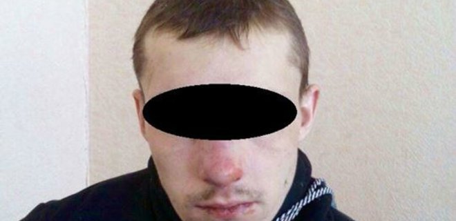 Задержан боевик, который принимал участие в обстрелах Счастья - Фото