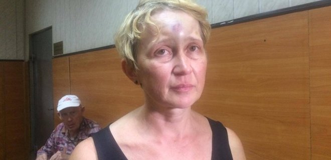 В Одессе избили журналистку - Фото