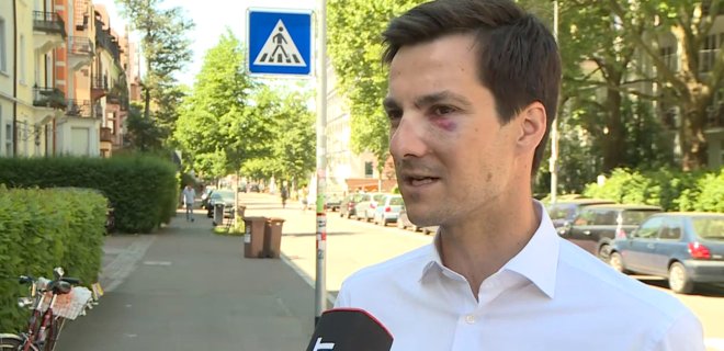 В немецком Фрайбурге сломали нос новоизбранному мэру - Фото