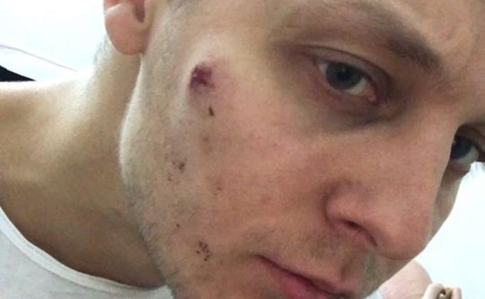 В Киеве избили старшего cына Нестора Шуфрича: фото