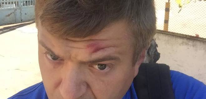 В Херсоне избили журналиста: фото - Фото