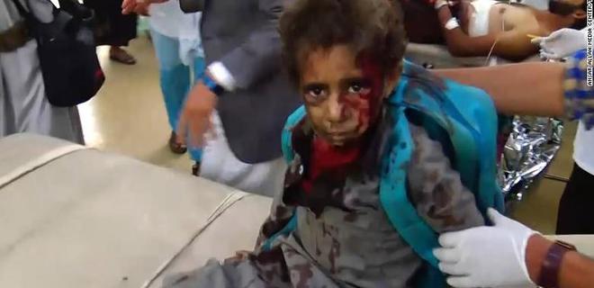 Удар по школьному автобусу в Йемене: число погибших выросло до 50 - Фото
