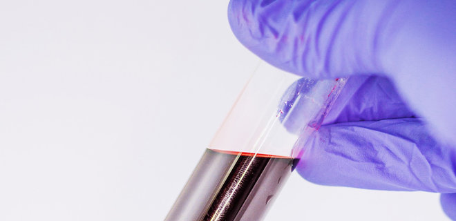 Ученые создали анализ крови, который может обнаружить 50 видов рака - Фото