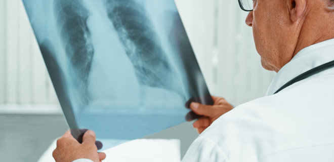 Минздрав запустил онлайн-тест для проверки на туберкулез - Фото