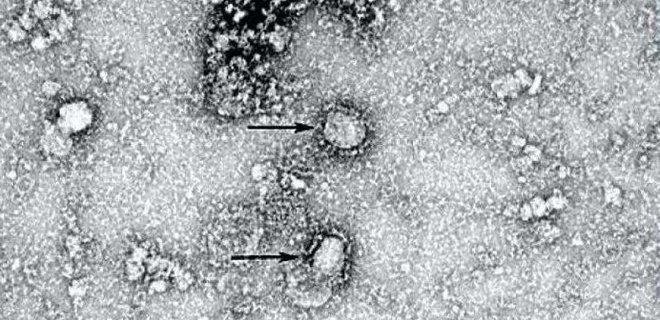 Появились первые фото китайского коронавируса - Фото