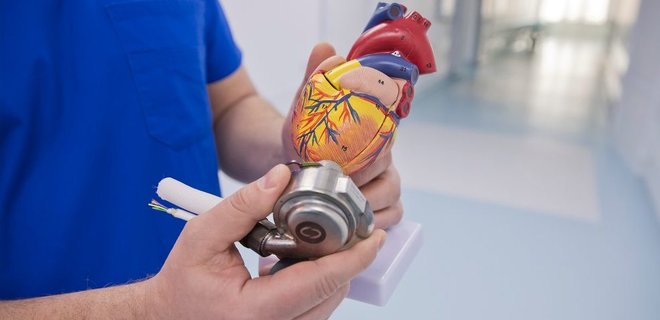 В Александровской больнице впервые поставили механическое сердце - Фото