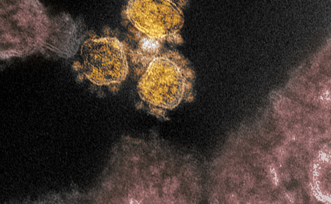 Новые снимки коронавируса SARS-CoV-2 под электронным микроскопом: фото