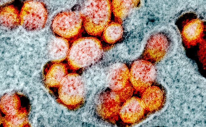 Новые снимки коронавируса SARS-CoV-2 под электронным микроскопом: фото