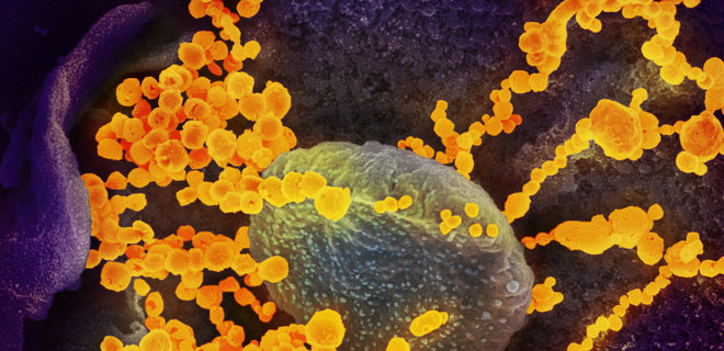 Не такая, как в Британии и ЮАР. В Нигерии обнаружена новая мутация коронавируса - Фото