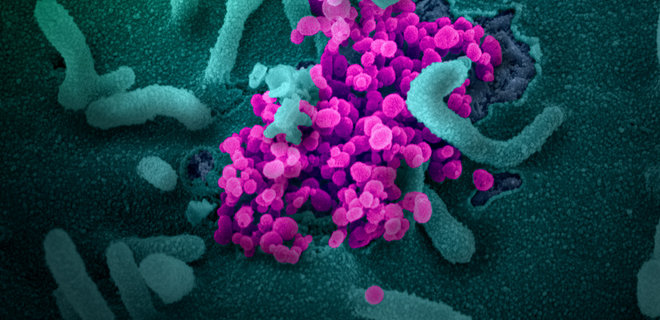 Новые данные о живучести коронавируса в воздухе и на вещах: исследование из США - Фото