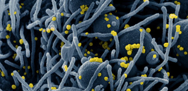 Инфицирование омикроном, возможно, дает защиту и от дельта-коронавируса: почему это важно - Фото