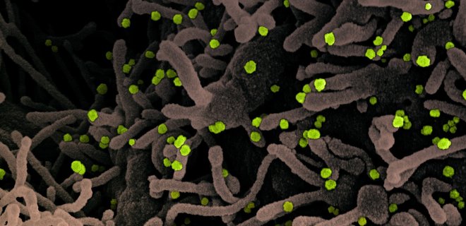 Альфа-штамм коронавируса научился тормозить врожденный иммунитет: что выяснили биологи - Фото