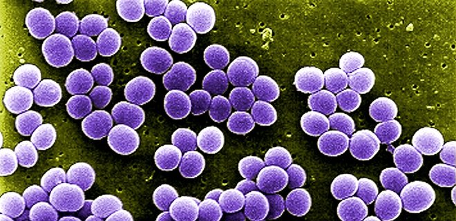 Новый препарат уничтожил даже самые устойчивые к антибиотикам бактерии – отчет - Фото