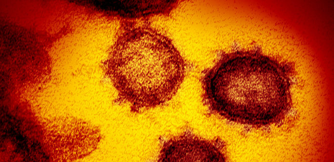 Ученые оценили летальность коронавируса в Испании, уточнили инкубационный период - Фото