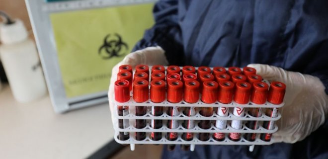 66% украинцев считают, что коронавирус был создан в лаборатории - опрос КМИС - Фото