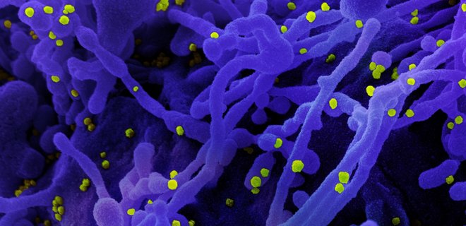 Ученые: Переболели простудой – у вас может быть клеточный иммунитет к COVID-19 - Фото