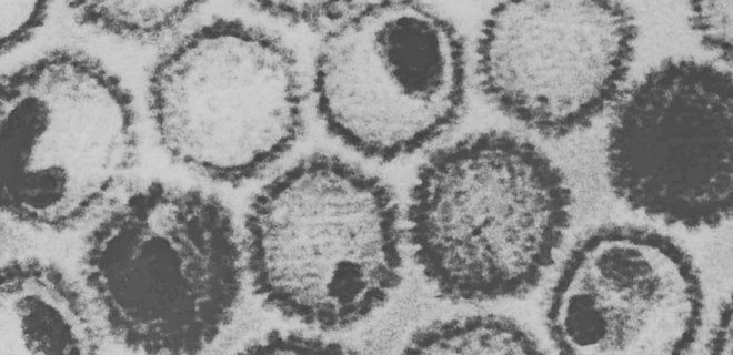 Организм впервые на 90% очистили от вируса герпеса: создан новый метод терапии - Фото