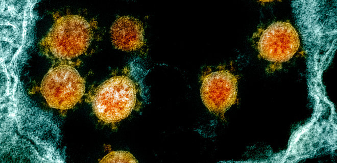 Живучесть. Частички коронавируса под микроскопом при 22 и 34 градусах по Цельсию – фото - Фото