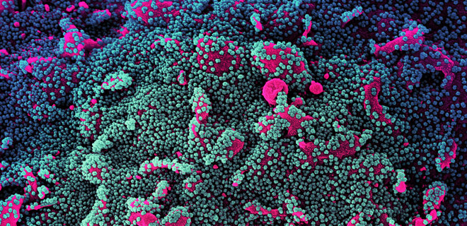 Британские ученые оценили, насколько заразнее новый мутантный штамм коронавируса - Фото