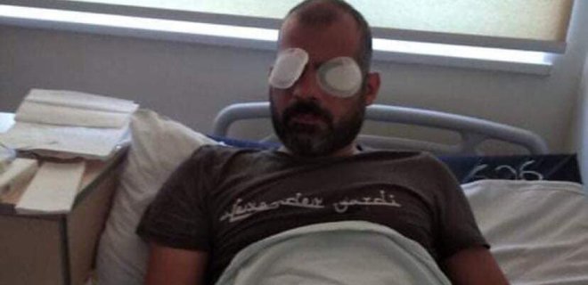 В Грузии избитый противниками ЛГБТ-марша журналист говорит, что ослеп на один глаз - Фото
