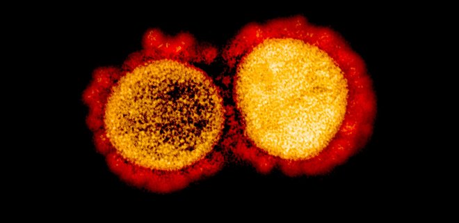 Ученые показали первые фото омикрон-штамма коронавируса SARS-CoV-2: два снимка - Фото