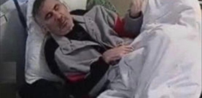 Состояние здоровья Саакашвили ухудшилось, омбудсмен требует пропустить его к заключенному - Фото